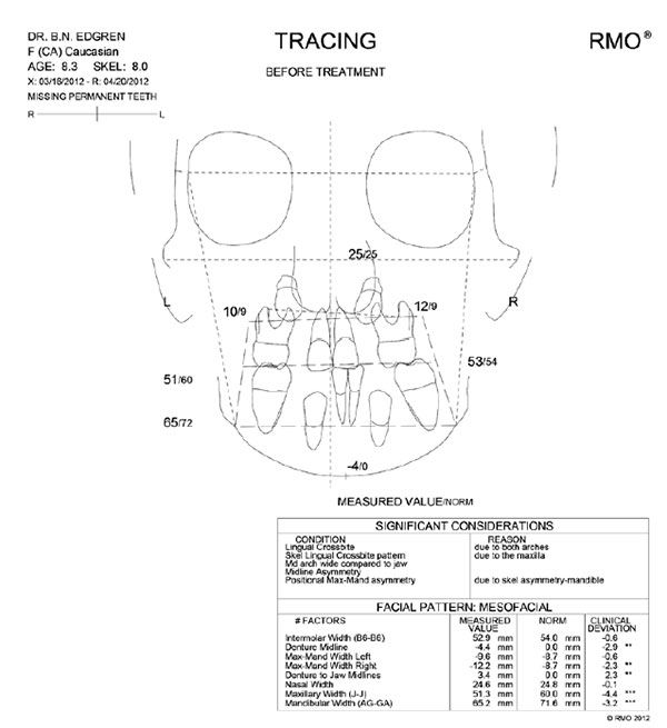 Figure 5: Frontal cephalometric analysis