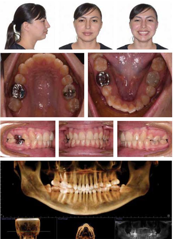 Fig 1 - 9