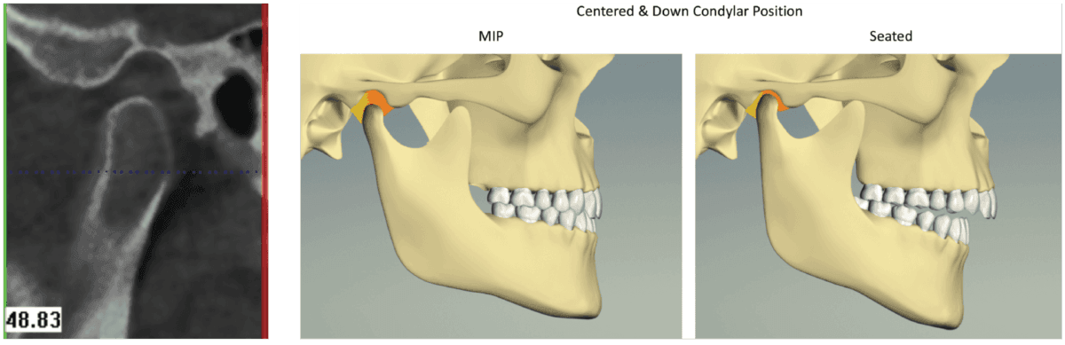 cone beam computed tomography guides orthodontists to detect