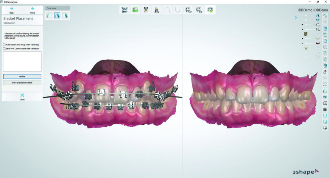 3shape ortho analyzer